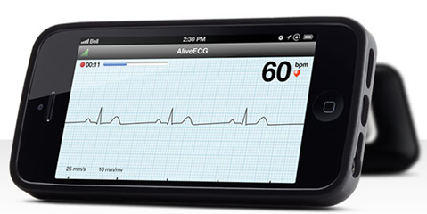 Alivecor iPhone ECG